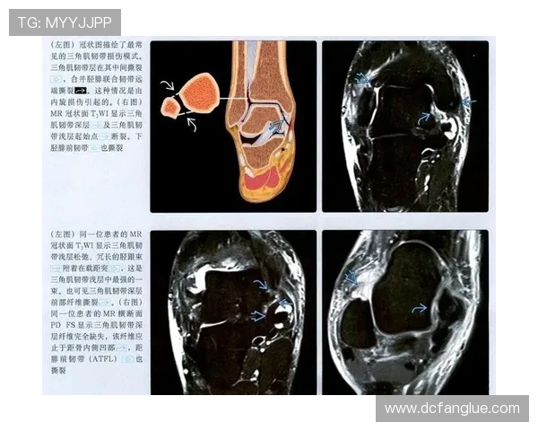 德岛漩涡官方山越康平外侧踝韧带伤